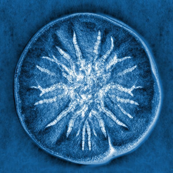 Microbial risk