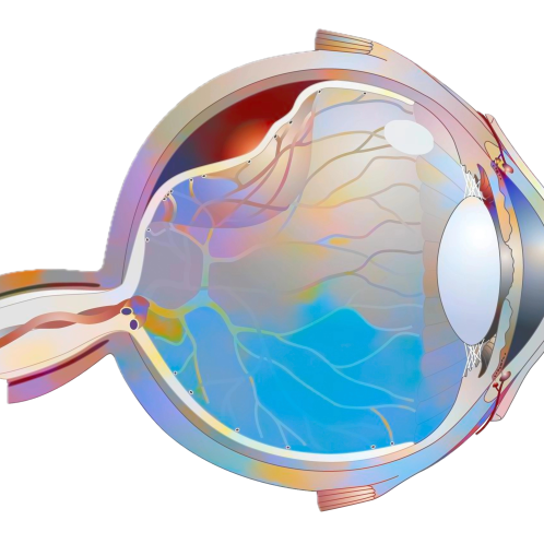 Retinal detachment Retinal detachment